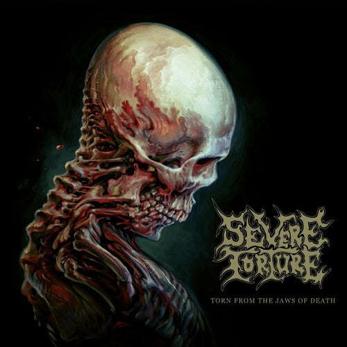 Severe Torture - Arraché aux mâchoires de la mort